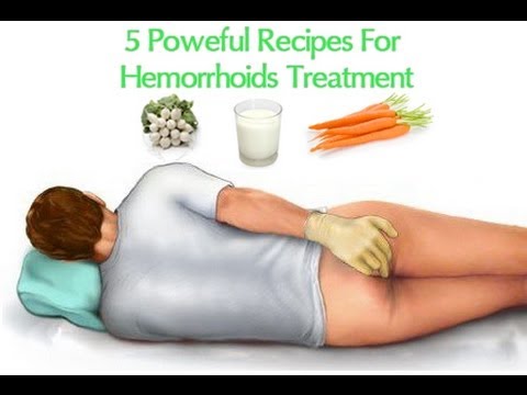 About hemorrhoids - Hemorrhoids Home Treatment